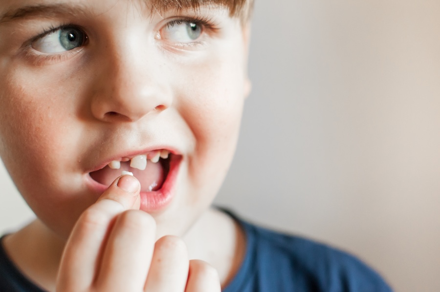 loose baby tooth